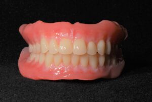 精密入れ歯(BPS義歯)のご紹介